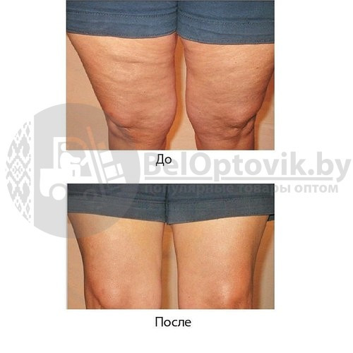 Антицеллюлитный пластырь для похудения INSTANT THIGH LIFT (8 шт). Моментальный лифтинг бёдер, ягодиц, живота - фото 3 - id-p153787465