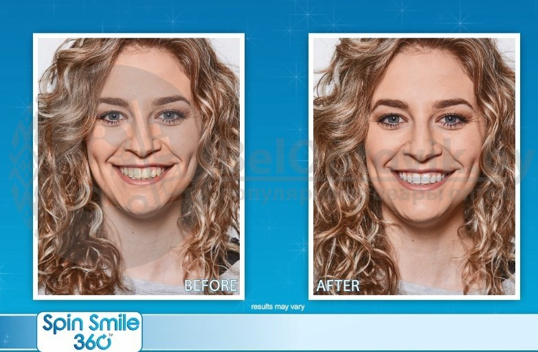 Набор для отбеливания зубов Spin Smile 360 Professional Grade Tooth Polisher - фото 8 - id-p153788704
