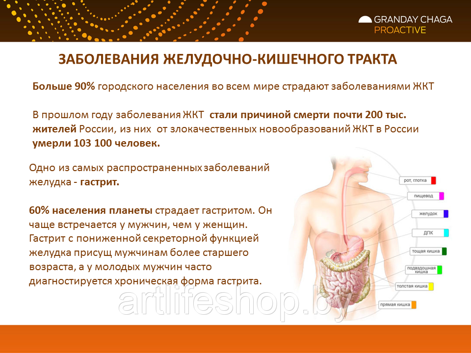 Пищеварительные заболевания. Заболевания желудочно-кишечного тракта. Заболевания ЖКТ патология. Симптомы заболевания органов ЖКТ. Заболевание пищевого тракта.