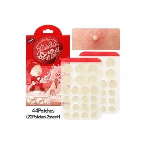 Точечные патчи от акне Elizavecca Witch Piggy Hell Pore Blemish Spot Patch