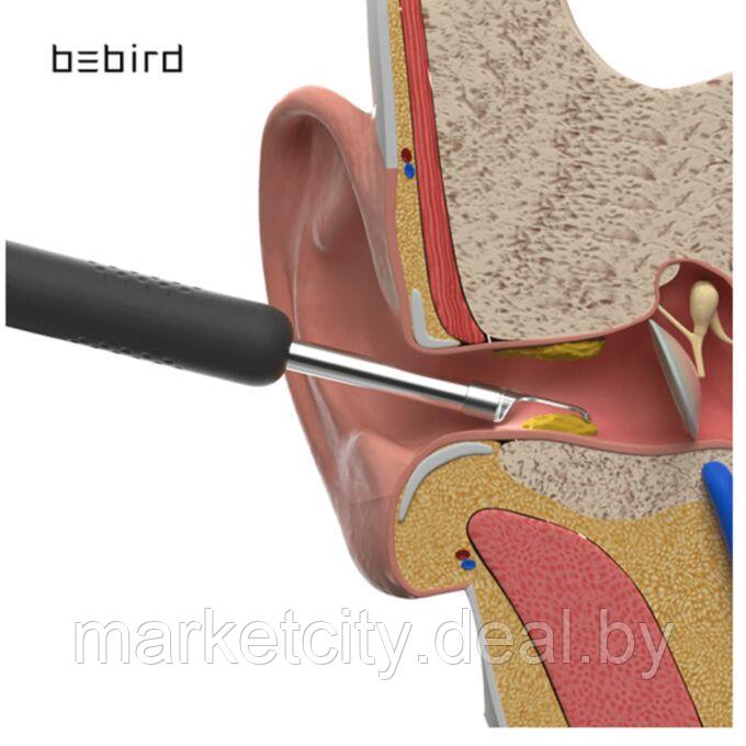 Умная ушная палочка Xiaomi Bebird Smart Visual Spoon Ear Stick R1 Белый - фото 1 - id-p157914996