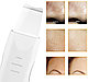 Аппарат для ультразвуковой чистки лица SiPL White, фото 4