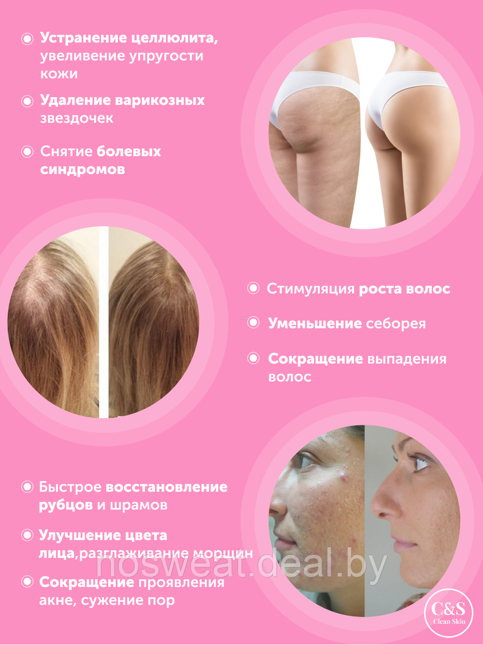 Дарсонваль Clean Skin YL-D01 (ID#159392987), цена: 99 руб., купить на  Deal.by