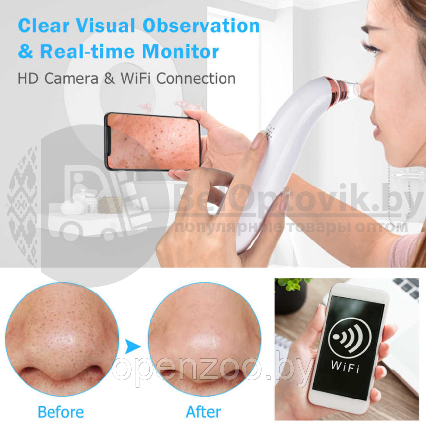 Вакуумный Wi Fi очиститель пор лица Visible Blackhead (5 насадок, просмотр через приложение) - фото 5 - id-p161676086