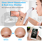 Вакуумный Wi Fi очиститель пор лица Visible Blackhead (5 насадок, просмотр через приложение), фото 5