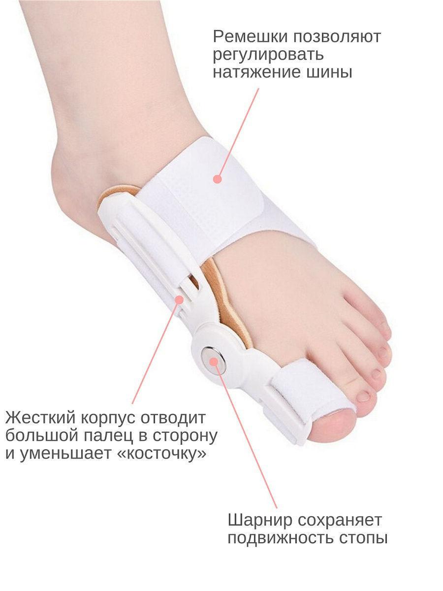 Вальгусная Шарнирная Шина "HALLUX VALGUS". Ортез для коррекции большого пальца стопы - фото 7 - id-p50187840