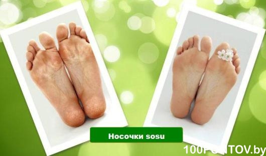 Педикюрные носочки SOSU (2 пары) - фото 4 - id-p16593931
