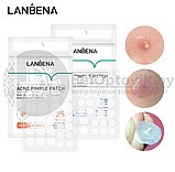 Ликвидация Стикеры - патчи (наклейки - пластыри) от прыщей и угрей LANBENA  ACNE PIMPLE PATCH (25 патчей), фото 8