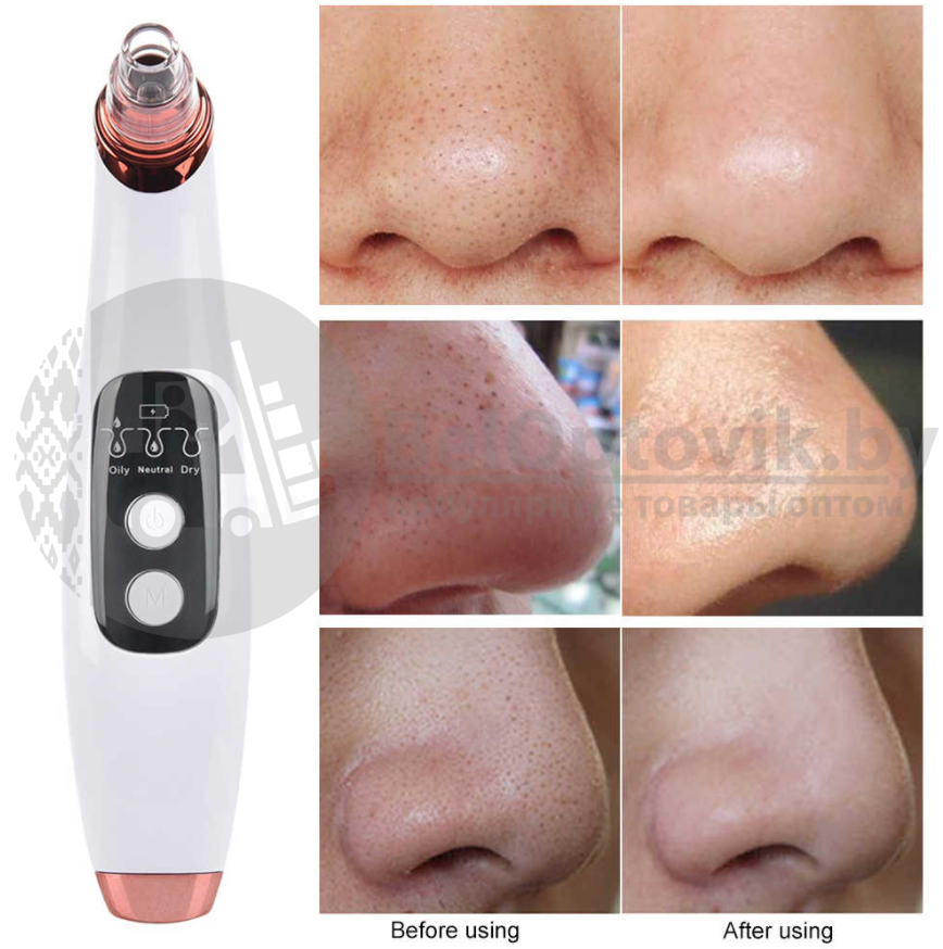 Вакуумный Wi Fi очиститель пор лица Visible Blackhead - фото 4 - id-p165727139