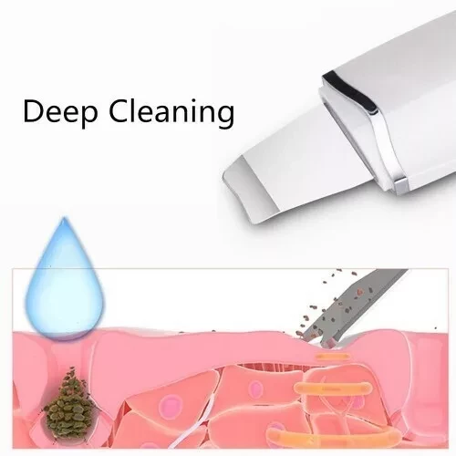 Ультразвуковой скребок для кожи Face Skin Cleaning Scrubber (Белый) - фото 4 - id-p166209867