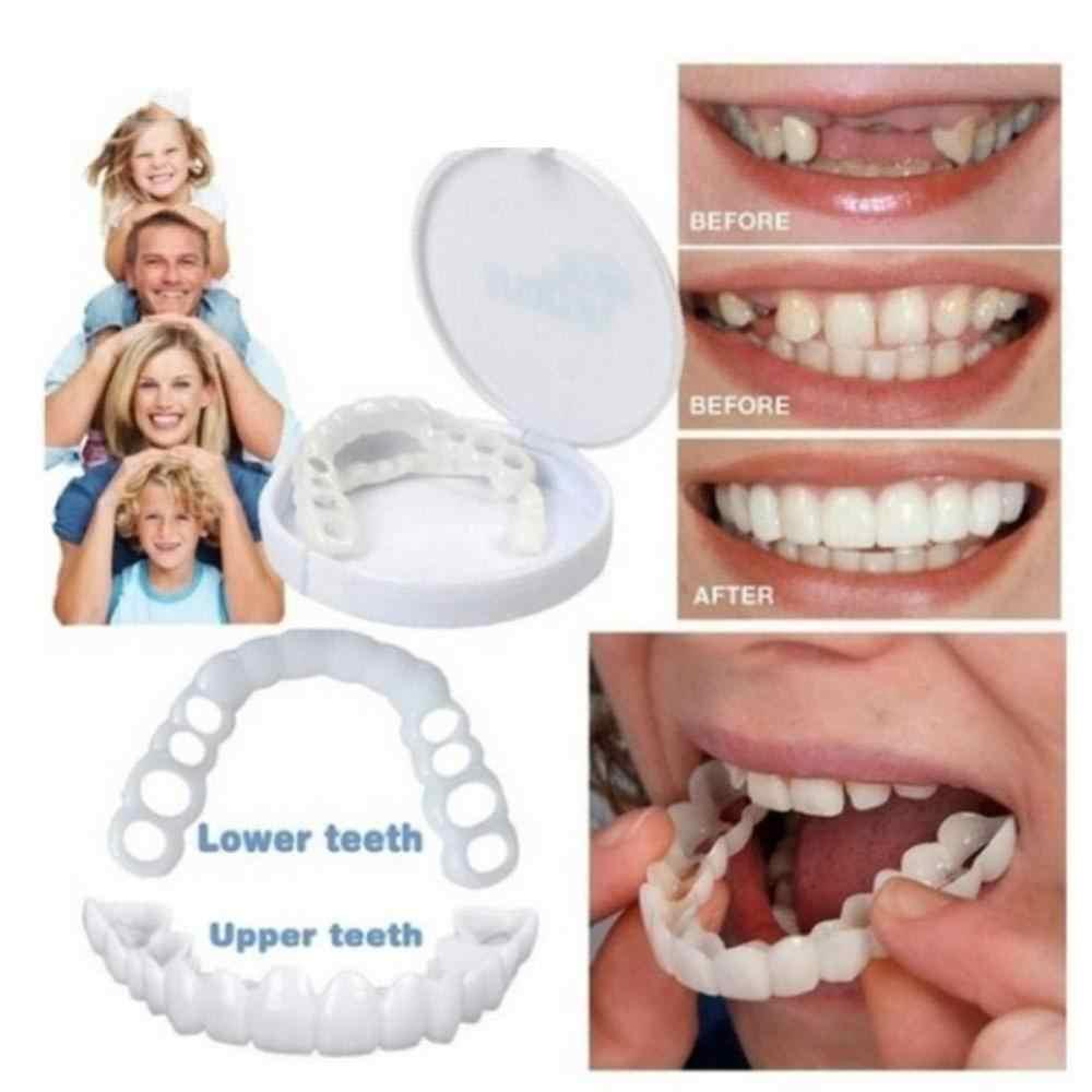 Набор для ВЕРХНИХ и НИЖНИХ зубов. Накладные зубы Snap on Smile