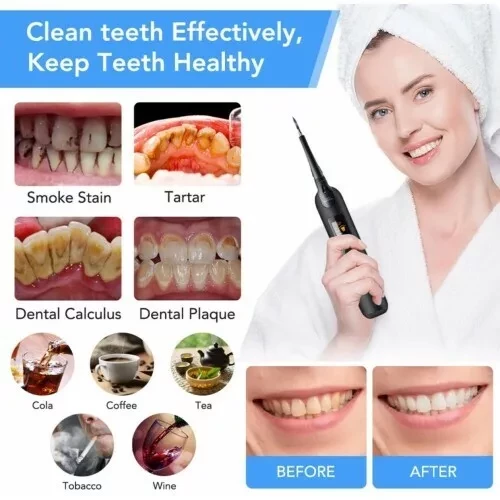 Прибор для чистки зубов Home-Use Dental Tools - фото 3 - id-p168489396