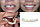 Накладные зубы (виниры) Snap on smile декоративные верх и низ, фото 6