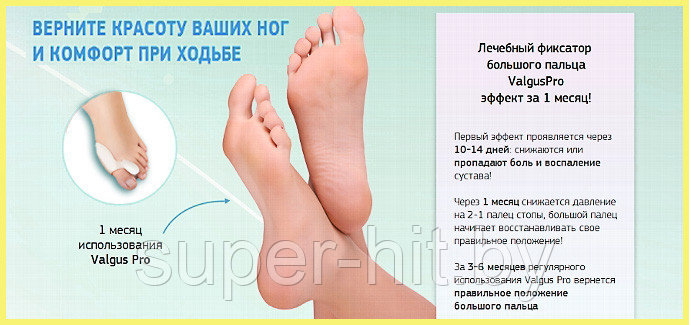 Фиксатор от косточки на ноге Valgus Pro Comfort - фото 2 - id-p170599882