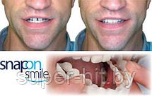 Накладные зубы Snap on Smile - Съемные виниры, фото 2