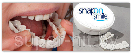 Накладные зубы Snap on Smile - Съемные виниры (ID#93060166), цена: 25 ...