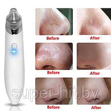 Вакуумный очиститель пор кожи лица Beauty Skin Care Specialist XN-8030 (2 модели), фото 3