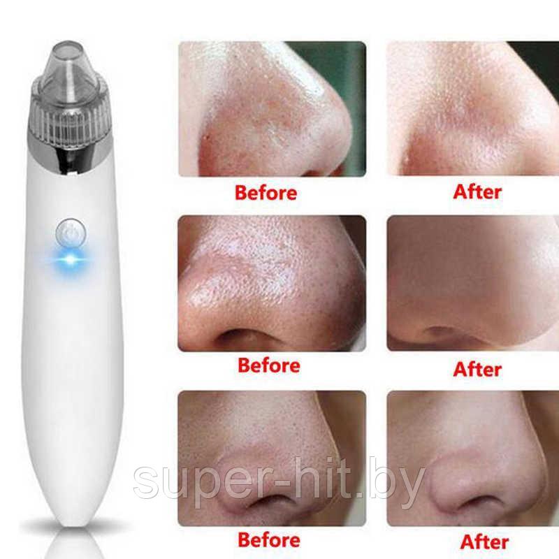 Вакуумный очиститель пор кожи лица Beauty Skin Care Specialist XN-8030 (2 модели) - фото 3 - id-p93060446