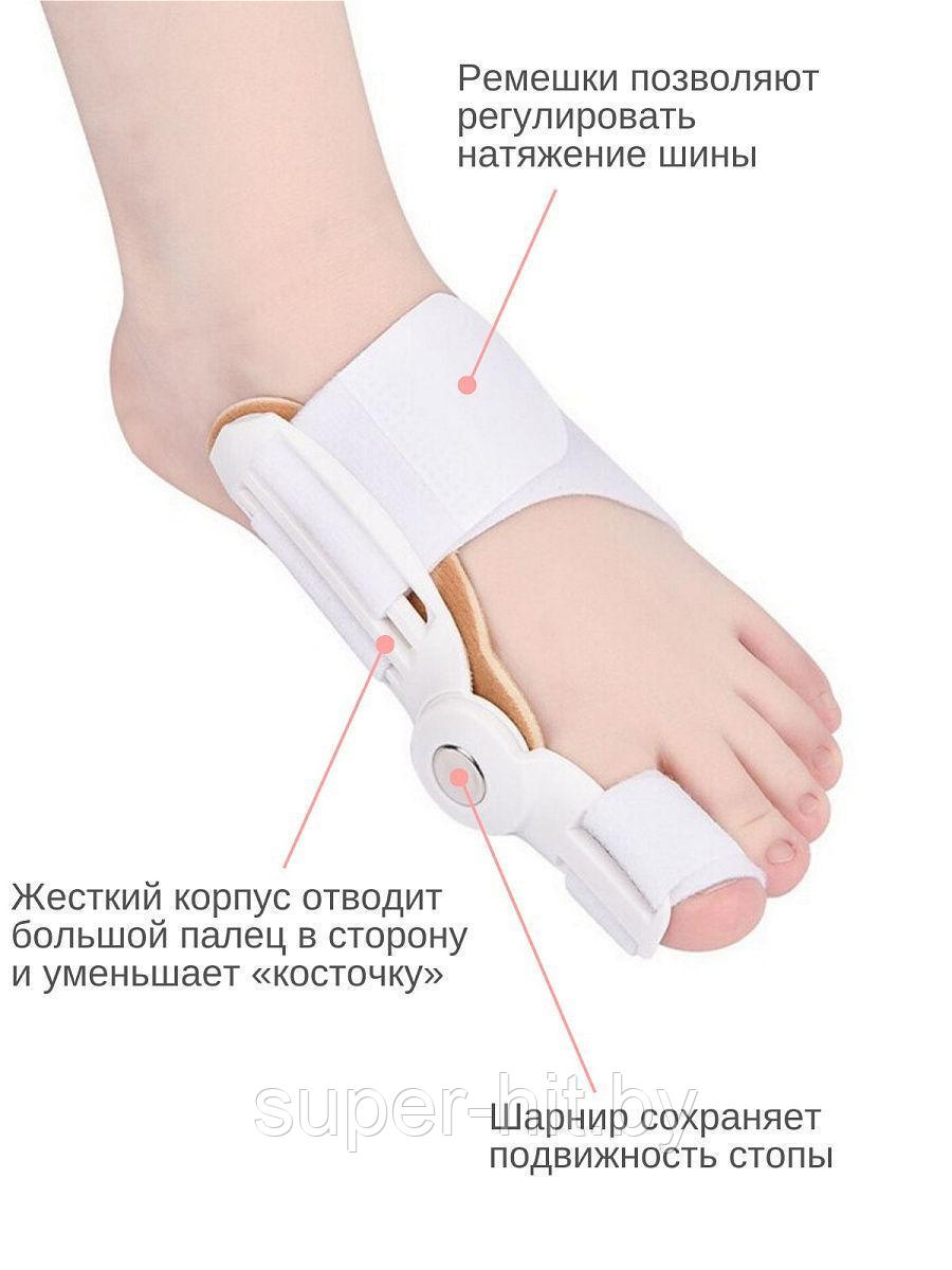 Вальгусная Шарнирная Шина "HALLUX VALGUS". Ортез для коррекции большого пальца стопы - фото 6 - id-p170607247