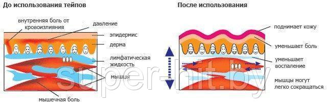 Кинезио тейп Kinesiology Tape - фото 4 - id-p170603756