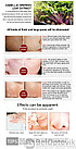 SOS Лечебная эссенция для сужения пор (от черных точек) Lanbena Serum Pore Treatment, 15 ml, фото 7