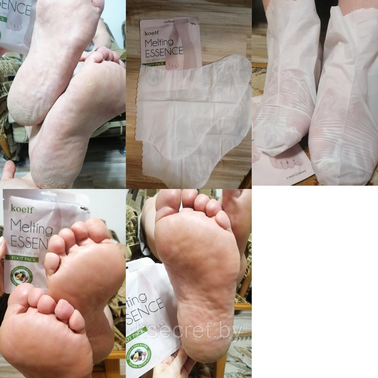 KOELF Маска-носочки для ног СМЯГЧАЮЩАЯ Melting Essence Foot Pack. - фото 4 - id-p144491420