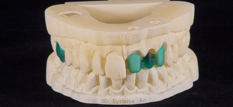 Профессиональный 3D принтер для стоматологии 3D Systems ProJet® MJP 3600 Dental - фото 3 - id-p172139816