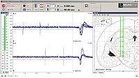 Электрофизиологическая управляющая программа Neurostar Neuro-Guide