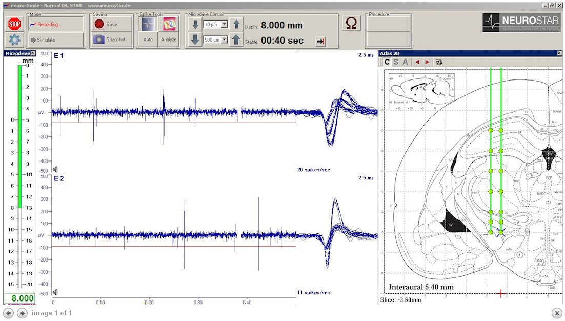 Электрофизиологическая управляющая программа Neurostar Neuro-Guide - фото 1 - id-p172143092