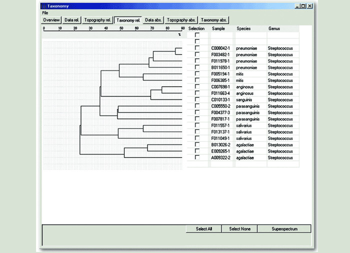 Система идентификации микроорганизмов (масс-спектрометр) Shimadzu AXIMA SARAMIS - фото 2 - id-p172651065