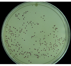 Счетчик колоний микроорганизмов UVP chemstudio ColonyDoc-It - фото 2 - id-p172728410