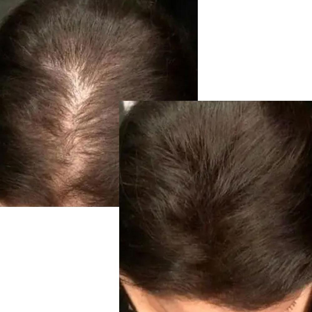 Концентрат Керастаз Аминексил Эдванс против выпадения и для укрепления волос 10x6ml - Kerastase Aminexil - фото 4 - id-p76711764