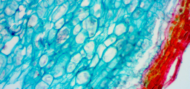 Микроскоп бинокулярный биологический Levenhuk 850B - фото 8 - id-p174920012