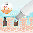 Ультразвуковой аппарат для пилинга и лифтинга с функцией увлажнения Sonic Skin Scrubber (3 режима работы, две, фото 6