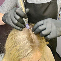 Безинъекционная мезотерапия волос
