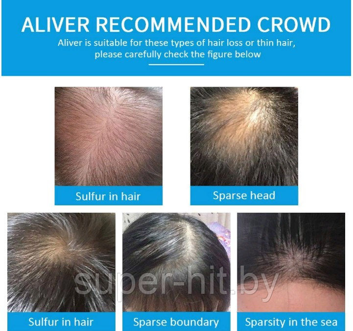 Загуститель для волос Aliver Hair Fibers ( Мedium Brown)+ насадка-распылитель - фото 7 - id-p177811627