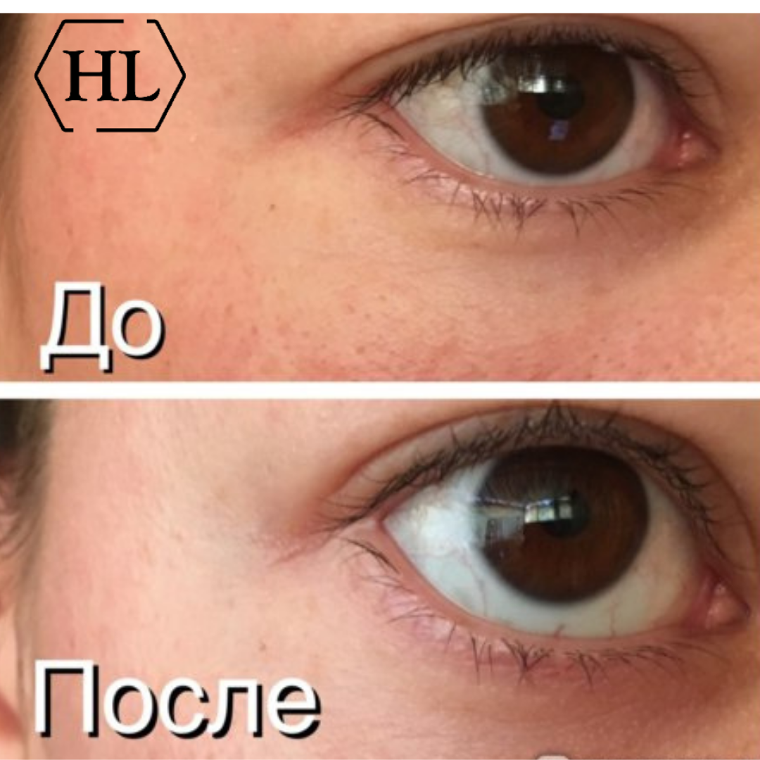 Крем для век с витамином С Holy Land C The Success Intensive Eye Cream - фото 4 - id-p119784731