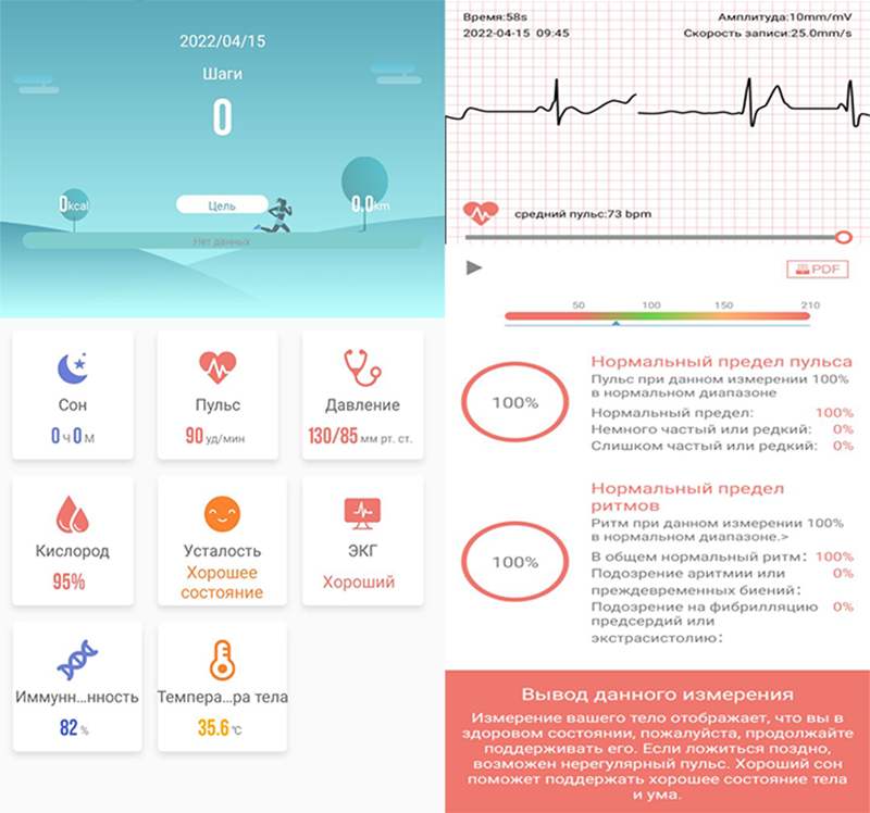 Браслет Здоровья Health Watch 21 в 1 - ЭКГ, Давление, Пульс, Кислород, Температура, Иммунитет - фото 5 - id-p178294698