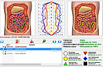 Биорезонансное тестирование всего организма