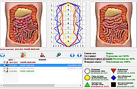 Биорезонансное тестирование всего организма