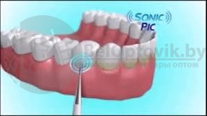 Средство для отбеливания зубов SONIC PIC Gentle at Home Dental Cleaning System - фото 4 - id-p179629780