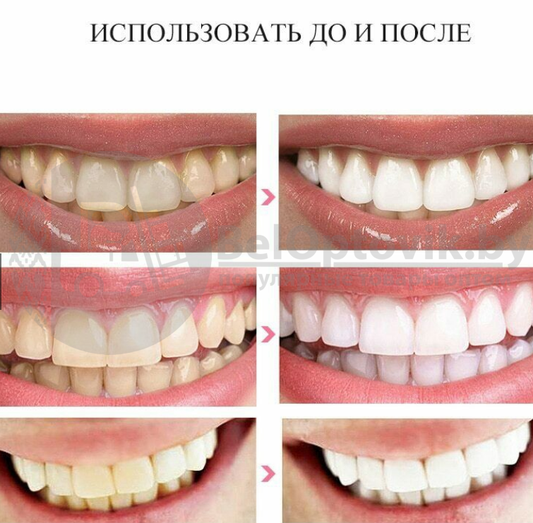 Отбеливающие полоски для зубов 3D White Teeth Whitening Stripes (упаковка: 7 комплектов полосок) - фото 3 - id-p179631087