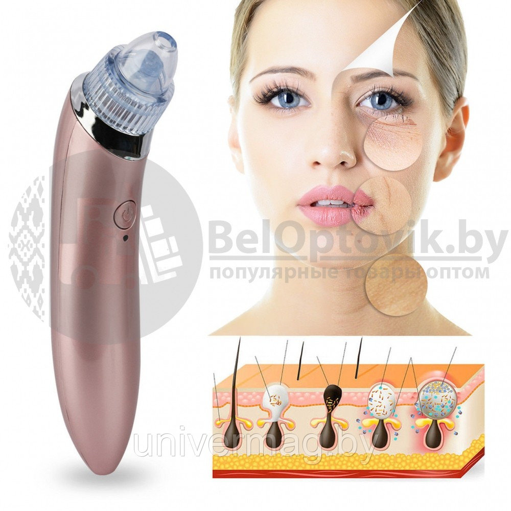 Вакуумный очиститель кожи Beauty Skin Care Specialist XN-8030 Розовый - фото 7 - id-p179625277