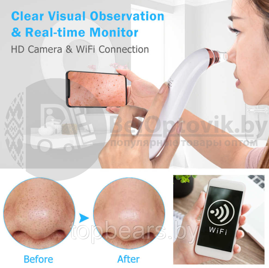 Вакуумный Wi Fi очиститель пор лица Visible Blackhead (5 насадок, просмотр через приложение) - фото 5 - id-p179743518