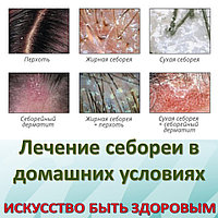 Лечение себореи в домашних условиях