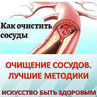 ОЧИЩЕНИЕ СОСУДОВ. ЛУЧШИЕ МЕТОДИКИ
