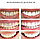 Отбеливающие полоски для зубов 3D White Teeth Whitening Stripes (упаковка: 7 комплектов полосок), фото 3