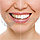 Средство для отбеливания зубов 20 Minute Dental White. NEW, фото 8