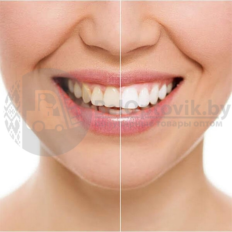 Средство для отбеливания зубов 20 Minute Dental White. NEW - фото 8 - id-p181594612