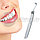 Средство для отбеливания зубов SONIC PIC Gentle at Home Dental Cleaning System, фото 5
